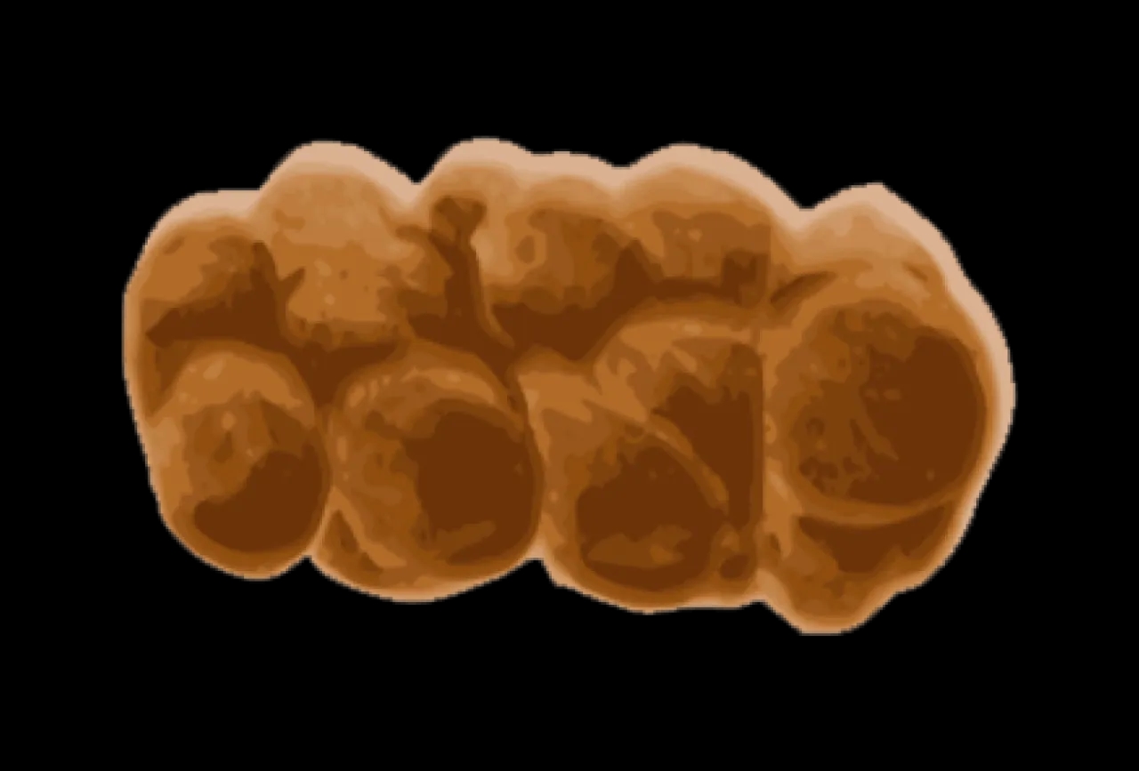 Jak wygląda kupka niemowlaka? Co mówi o zdrowiu Twojego dziecka?
