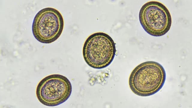 Czy podczas odrobaczania dziecko może chodzić do przedszkola? Ważne informacje